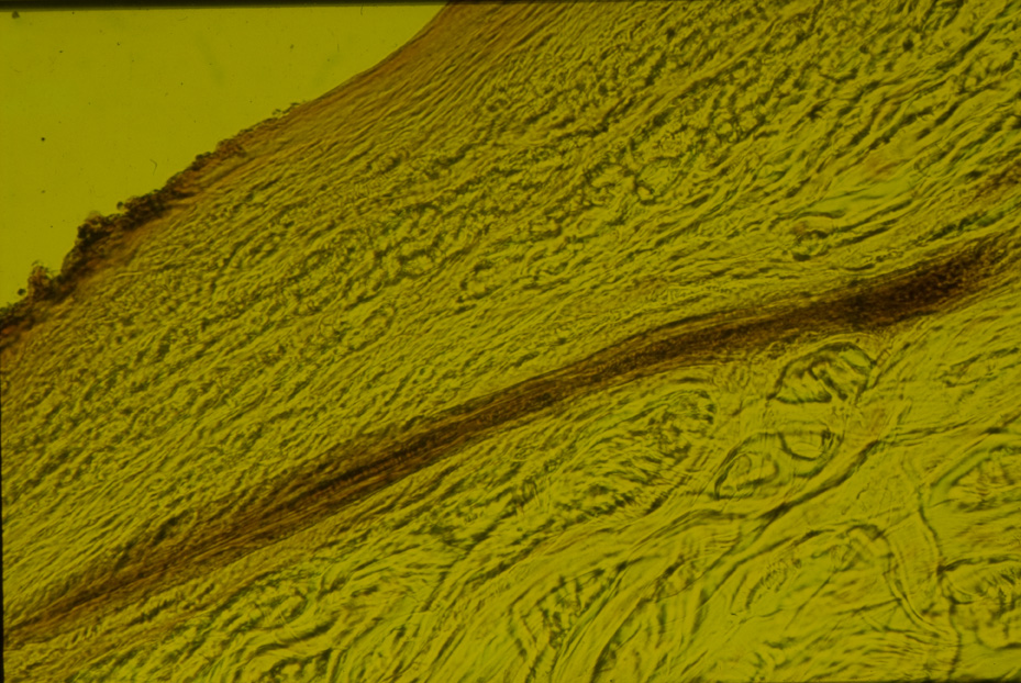 Microfotografia. Studi per l'identificazione della specie
icpal_14846
Keywords: ICPL Studi indentificazione specie, Microfotografie, ICPL