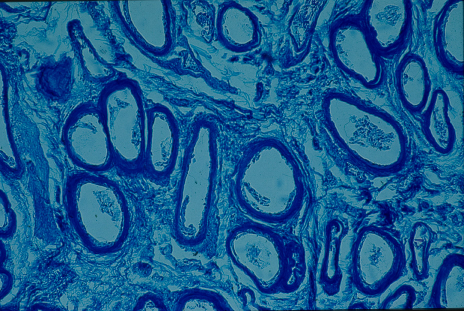 Microfotografia. Ricerca e diagnostica sui materiali
icpal_14896
Keywords: ICPL, Diagnostica materiali, Microfotografie