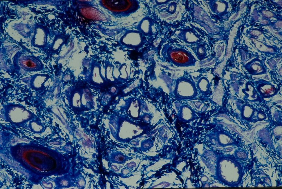 Microfotografia. Ricerca e diagnostica sui materiali
icpal_14898
Keywords: ICPL, Diagnostica materiali, Microfotografie