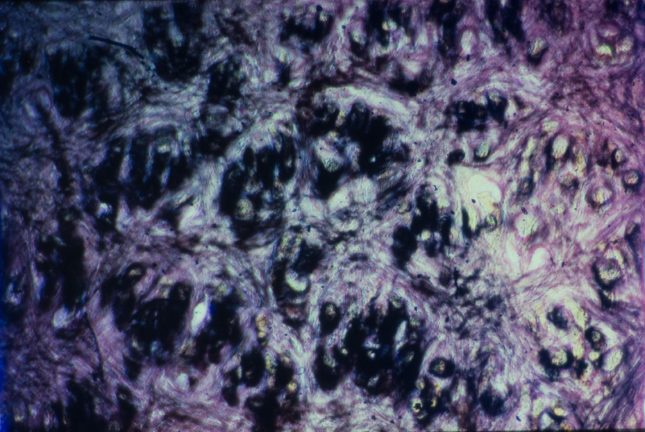 Microfotografia. Studi per l'identificazione della specie
icpal_14974
Keywords: ICPL Studi indentificazione specie, Microfotografie, ICPL