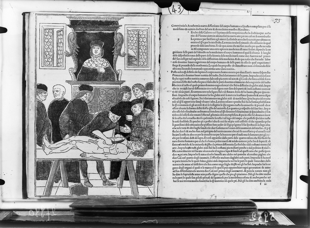 Parma, Biblioteca Palatina, MM.VII.317 - IGI 5300
doc_05932
Keywords: Parma Palatina MM.VII.317, IGI 5297, Incunaboli, Parma Palatina